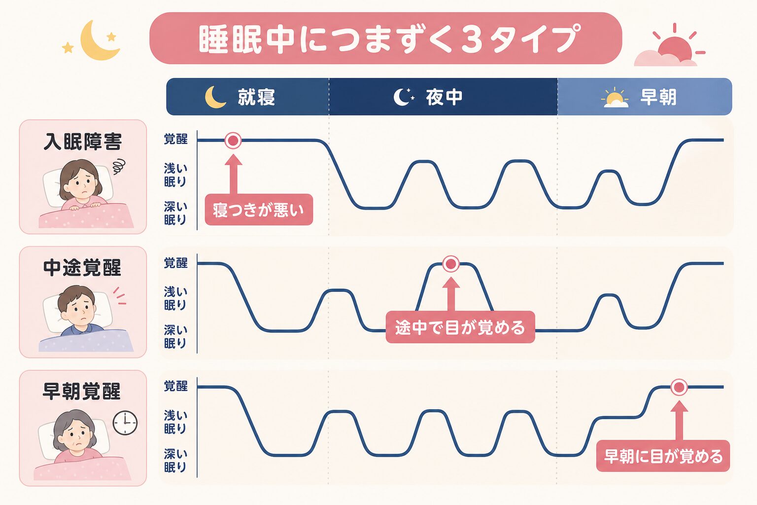 不眠の3タイプが睡眠のどの時間帯で起きるかを示した図